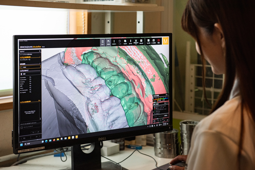 CAD/CAM冠につきまして